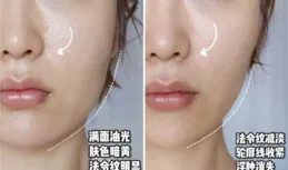 Tripollar 這款射頻美容儀怎麽樣?