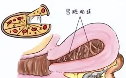 打過胎的女性，身體會留下這些「痕跡」，婦產科醫生一看就知道