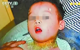 09年，母親帶3歲兒子洗藥浴，不料濕疹洗成絕癥，臥底2年討公道