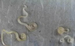 男子約會後腹痛發熱，檢查肝臟「被掏空了」，醫生起一身雞皮疙瘩