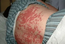 針對「身患紅斑狼瘡晚期的上海女子沙白，赴瑞士自殺」掀起輿論熱潮，你怎麽想？