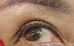 守護孩子明亮雙眼：揭秘眼睛發紅原因與護眼方法