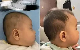 嬰幼兒小時候用不用枕頭區別真的很大。寶媽要牢記