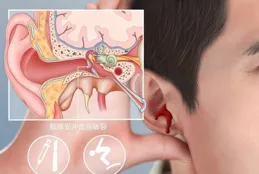 寶寶耳朵別亂掏！如何掌握「正確姿勢」？寶媽收藏