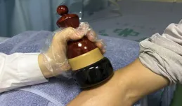 冬季三九天——祛濕升陽黃金期，常用的艾灸你一定要知道！！！