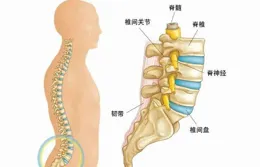 腰椎酸痛、腰间椎盘突出、腰肌劳损怎么办？用李时珍腰椎喷剂，腰部小白瓶