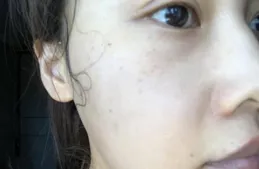 怎樣才能淡化祛斑？