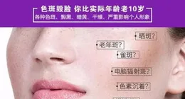 為啥臉上會有大片黃褐斑，弄得每天心情都不好了，該怎麽調理?求解？