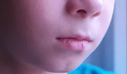 幹燥起皮、反反復復，唇炎究竟為什麽那麽難纏？