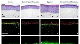 抗糖皮膚真的會好嗎？