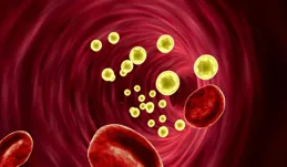 血管健康人長壽，別讓動脈粥樣硬化成為你健康的「定時炸彈」