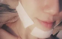 素茉爾品牌的水楊酸祛痘精華液怎麽樣？