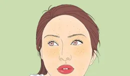 15% 壬二酸真的能祛痘印嗎?