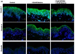 我是油性皮膚，有什麽推薦控油水乳，價錢300以內的?