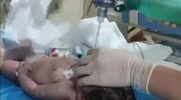 命懸一線「冰墩墩」寶寶的重生之路