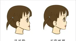 萌娃吃藥哭鬧被班裏同學看到後反轉，網友卻說：反頜？要盡早幹預