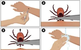 天氣轉暖，外出遊玩小心蜱蟲叮咬