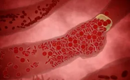 男孩腳腫查出肝上長滿「痘痘」！醫生：這是什麽神奇的疾病？