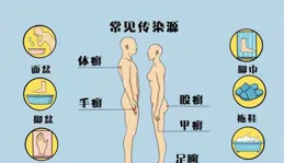 為什麽腳氣經常反復發作？