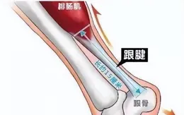 【健康知識】春季運動如何做「足」準備？