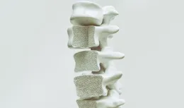 老年人補鈣有用嗎？該如何科學對抗骨質疏松呢？醫生給出全面解答