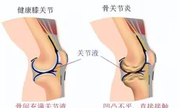 跑步也會上癮嗎？跑步成癮弊大於利，請三思而後行