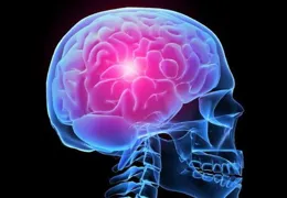 腦出血是什麽感覺的？