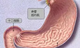 膽汁反流：胃與食管的隱形「攻擊者」