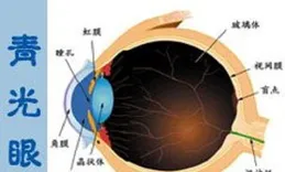 88歲退休老兵被青光眼和白內障雙重困擾，專家妙手助其重見光明