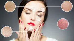 如何快速有效的去紅血絲?