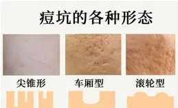 砌堂椒匣桑諒蹲太填火蛋請浩？洽道聳承糞昆糠校幕舒？