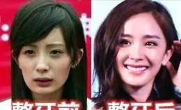 你有因為容貌焦慮想過整容嗎？網友：這些千萬別做！感染直接死！