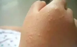 夏天給寶寶洗澡，這5個部位不能洗太幹凈了，小心坑了娃