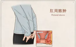 22歲小夥擠了個「痘」，結果坐著輪椅進醫院！