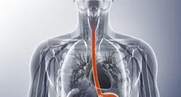 占位一定是腫瘤嗎