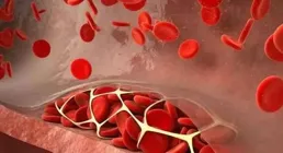 B肝患者機體損傷原因揭示——肝臟血管細胞讓免疫系統「休眠」