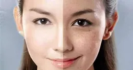 這到底是什麽斑？怎樣才能去除？