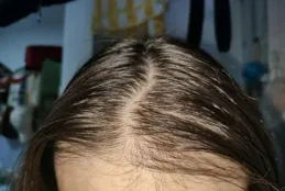 今天才知道，男人盡量不要剃光頭！三大原因，讓人恍然大悟