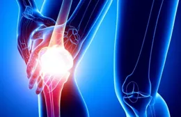 「血栓大戶」被揪出！再次提醒：勸您少吃4種食物，越吃血管越堵