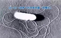 「一杯飲品」怎成孕期‘隱形刀’？早產寶貝驚險，警鐘響徹心間！