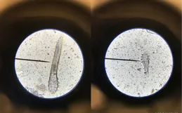 趁你睡覺爬上你的臉，還在你臉上交配，對你的依賴讓它們走上絕路