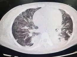 在太空給大氣雲雨做「CT」