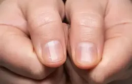 肺癌和習慣有關系？醫生:想看自己有沒肺癌，快看有沒有這幾個特征