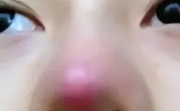 身體4處發紅，是肝臟在求救？醫生警告：出現幾種異常，趁早就醫