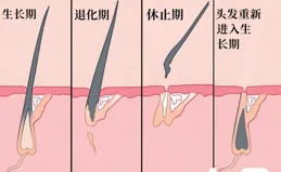 聽說拔掉「發王」，頭發就會細軟塌還禿頭？