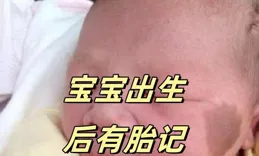 為什麽寶寶出生後有胎記？避免4種行為！
