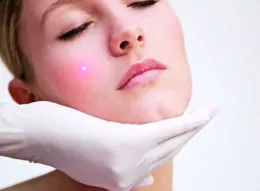 皮膚色斑與痤瘡治療：科學應對，美麗回歸