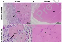 基於脂質體自組裝的可註射水凝膠用於控制釋放親水小分子