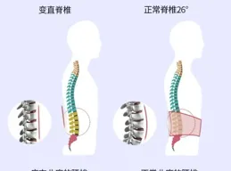 久坐族的「撐腰」神器！矯正坐姿，解放腰椎
