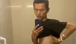 百萬粉絲網紅咖啡患直腸癌去世，年僅 29 歲，為什麽患直腸癌的年輕人越來越多？哪些人容易得直腸癌？